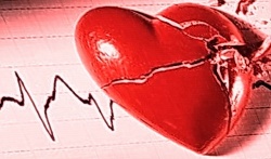 сердечная недостаточность симптомы лечение, отеки +при сердечной недостаточности, сердечно сосудистая недостаточность, помощь +при сердечной недостаточности, признаки сердечной недостаточности, сердечная недостаточность возраст, первая помощь +при сердечной недостаточности, 