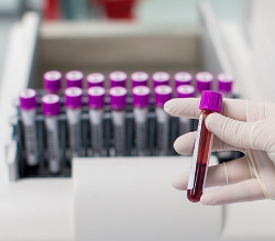 Анализ крови может  помочь диагностировать  тяжелые виды онкологических заболеваний