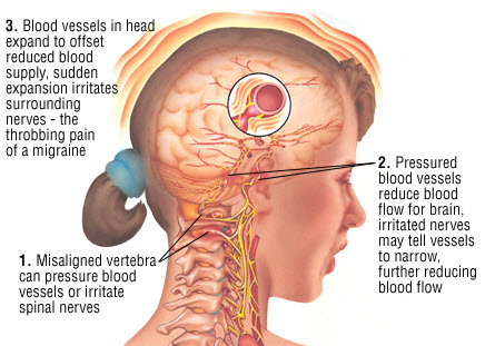 Лечение головной боли на приеме у квалифицированного врача-невролога